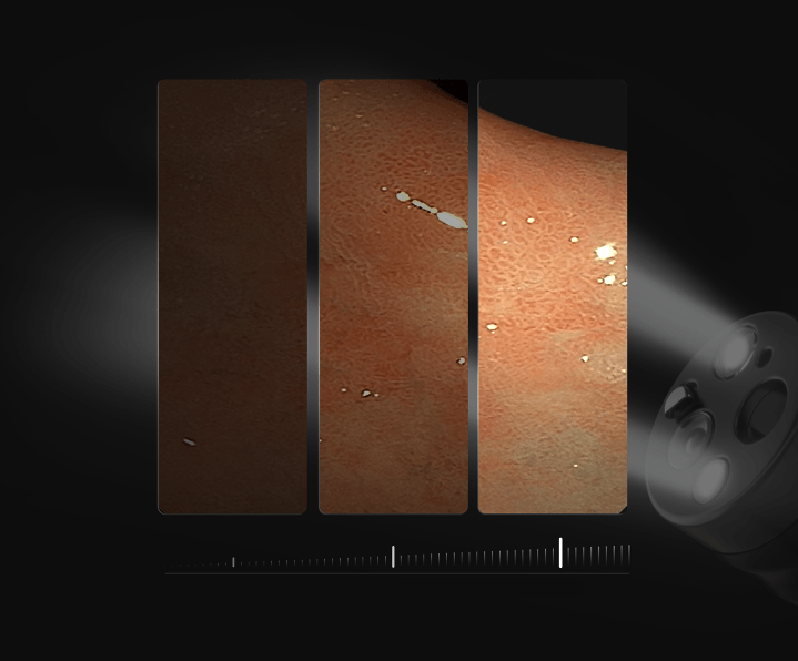 AQ-100 Endoscopy Solution - Image 10