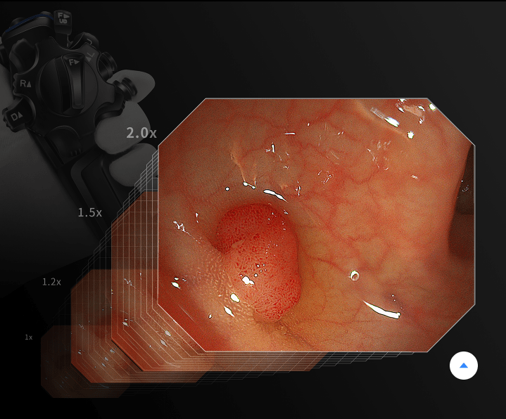 AQ-100 Endoscopy Solution - Image 9