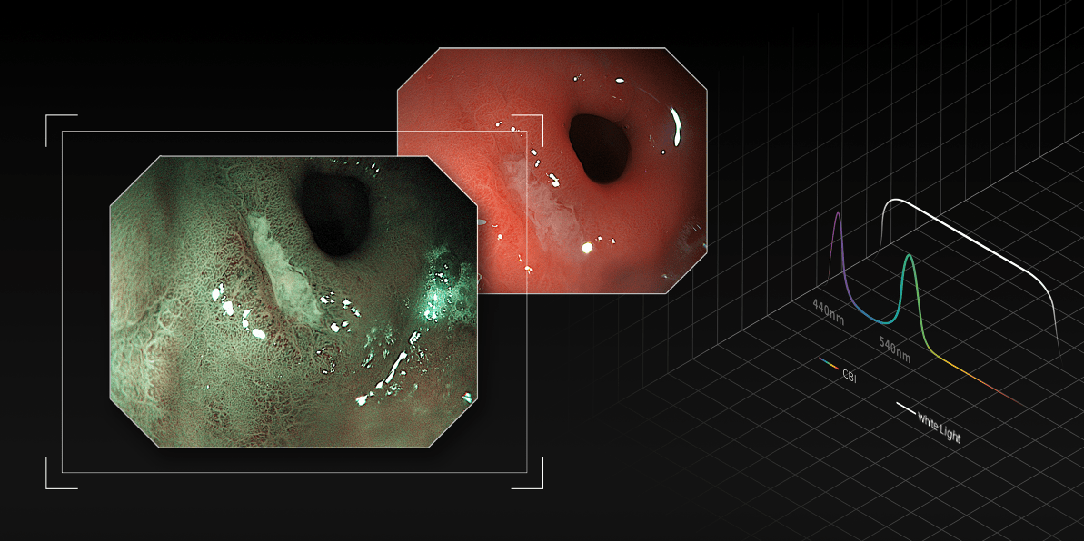AQ-100 Endoscopy Solution - Image 8