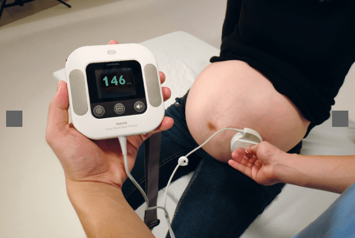 Moyo - Fetal Heart Rate Monitor
