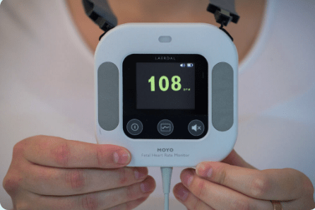 Moyo - Fetal Heart Rate Monitor - Image 2