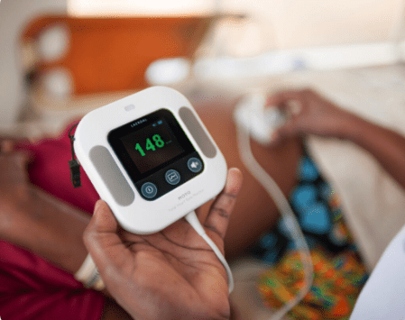 Moyo - Fetal Heart Rate Monitor - Image 3