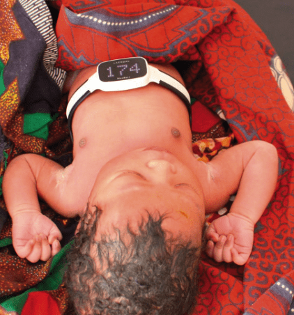 NeoBeat: Newborn Heart Rate Meter